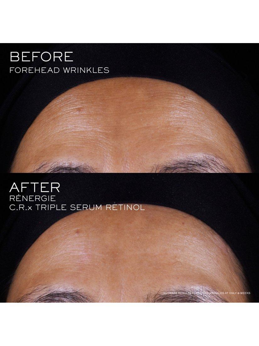Lancôme Rénergie C.R.X Triple Serum Retinol, UK version
