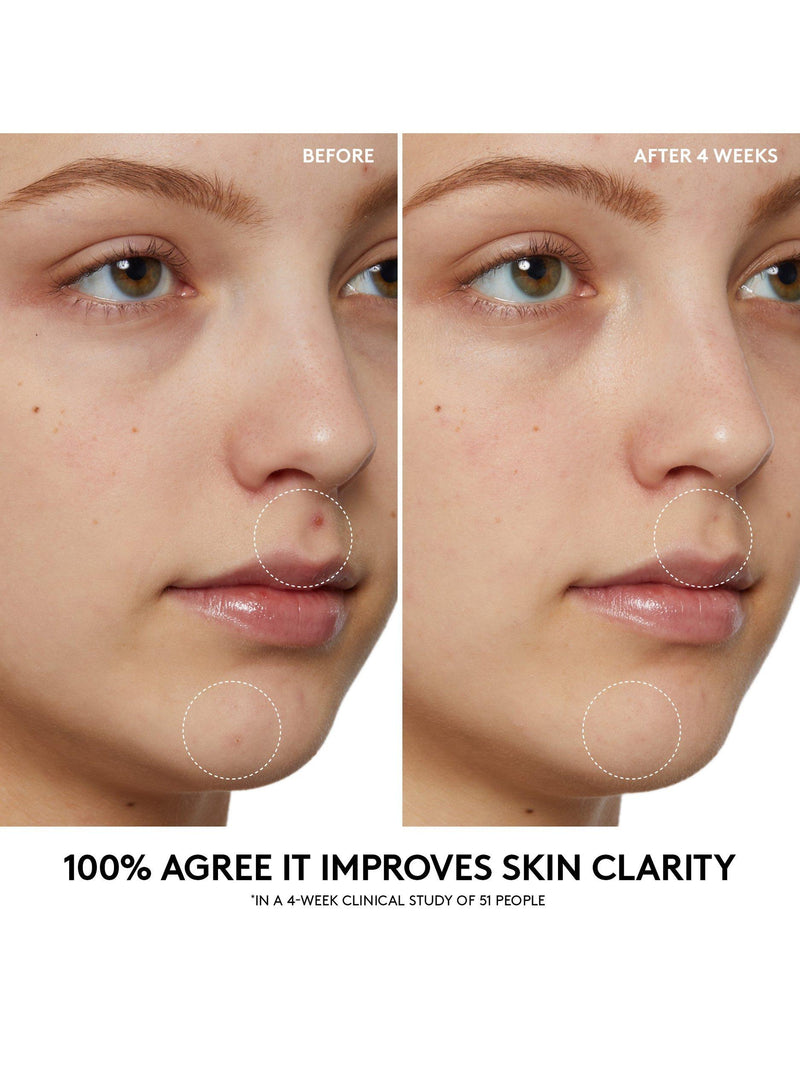 Fenty Skin cherry pore purifying gel cleanser 190ml - British product