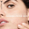 Vichy Normaderm Double Correction Daily Moisturiser 50ml (British brand)