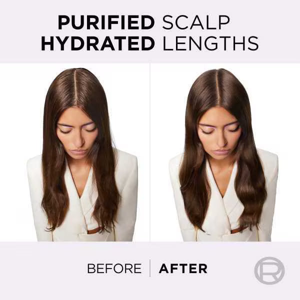 L'Oreal Paris Elvive Hydra Pure Scalp Serum, UK version