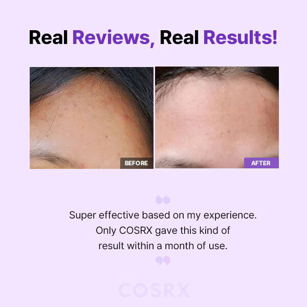 Cosrx Aha Bha Clarifying Treatment Toner 150ml, UK version