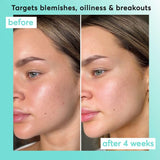 Super Facialist Clear Skin Pore-fect Daily Moisturiser