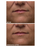 Dr Dennis Gross Alpha Beta Gentle Peel (5 Treatments)