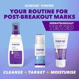 Cetaphil Purifide Post-Breakout Serum 30ml, imported from the UK