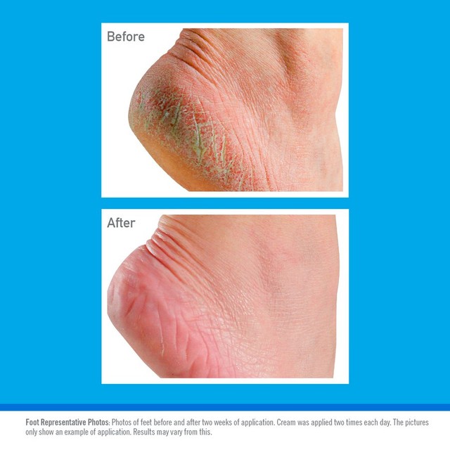 O'Keeffe's Healthy Feet unscented foot cream 85g, imported from the UK