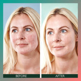 Sorted Skin 5 in 1 Anti-Redness SPF50 Day Cream - Prebiotic Microbiome