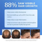 BosleyMD BOSRevive conditioner 1L - British product