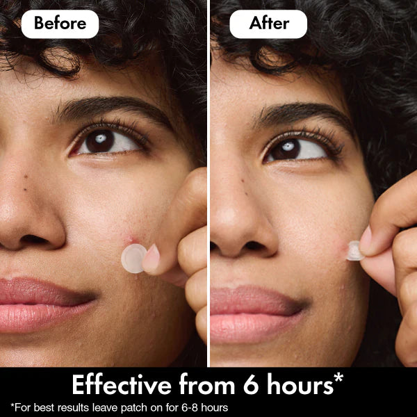 Hero Mighty Patch Mini Invisible Pimple Patches 30ct, UK version