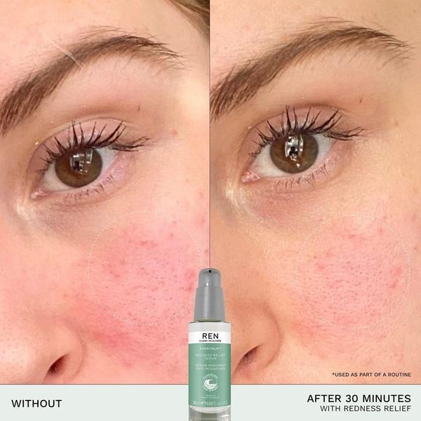REN Mini Evercalm Redness Relief Serum 15ml, imported from the UK