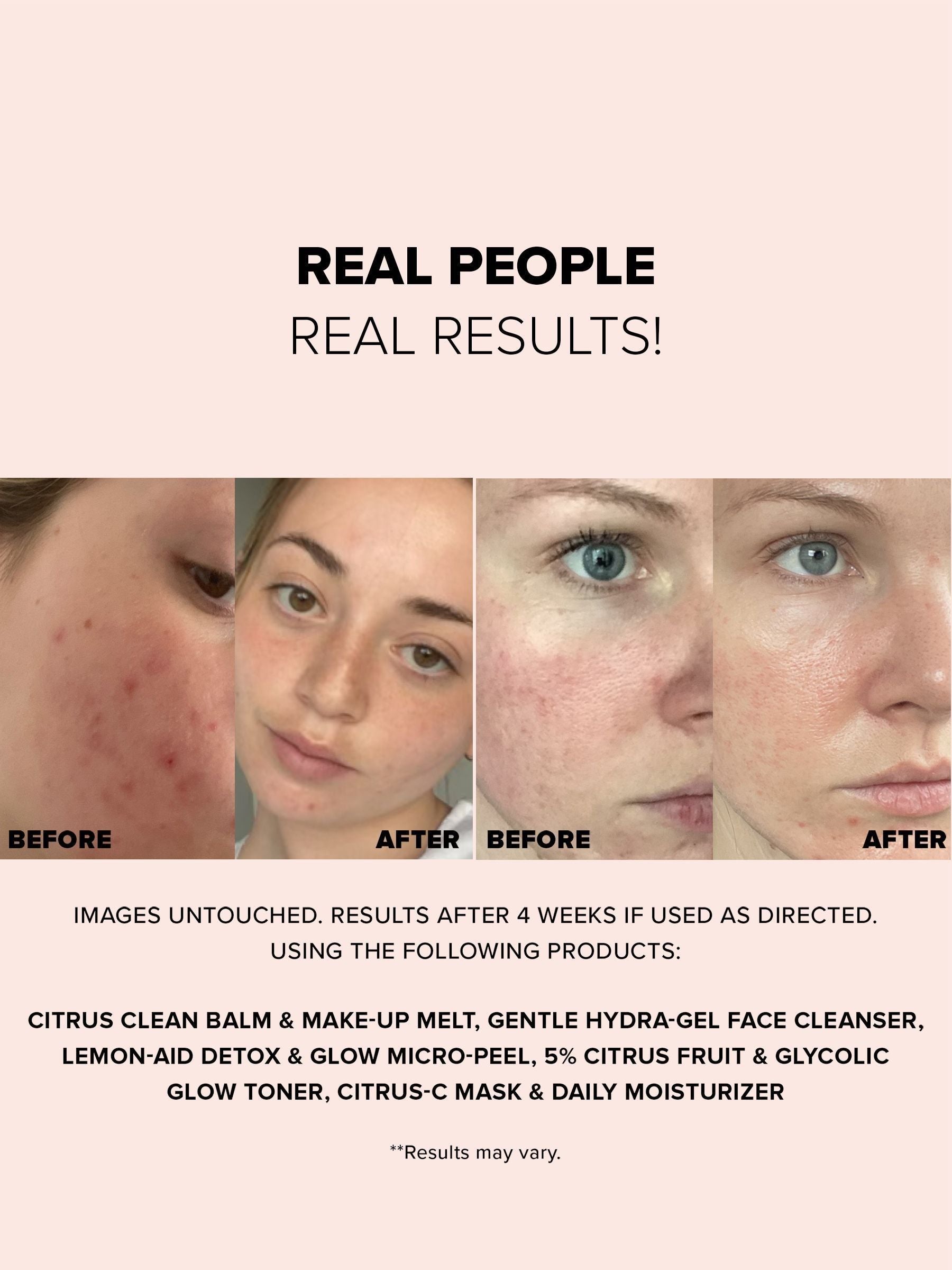 NUDESTIX Nudeskin Gentle Hydragel Face Cleanser 70ml