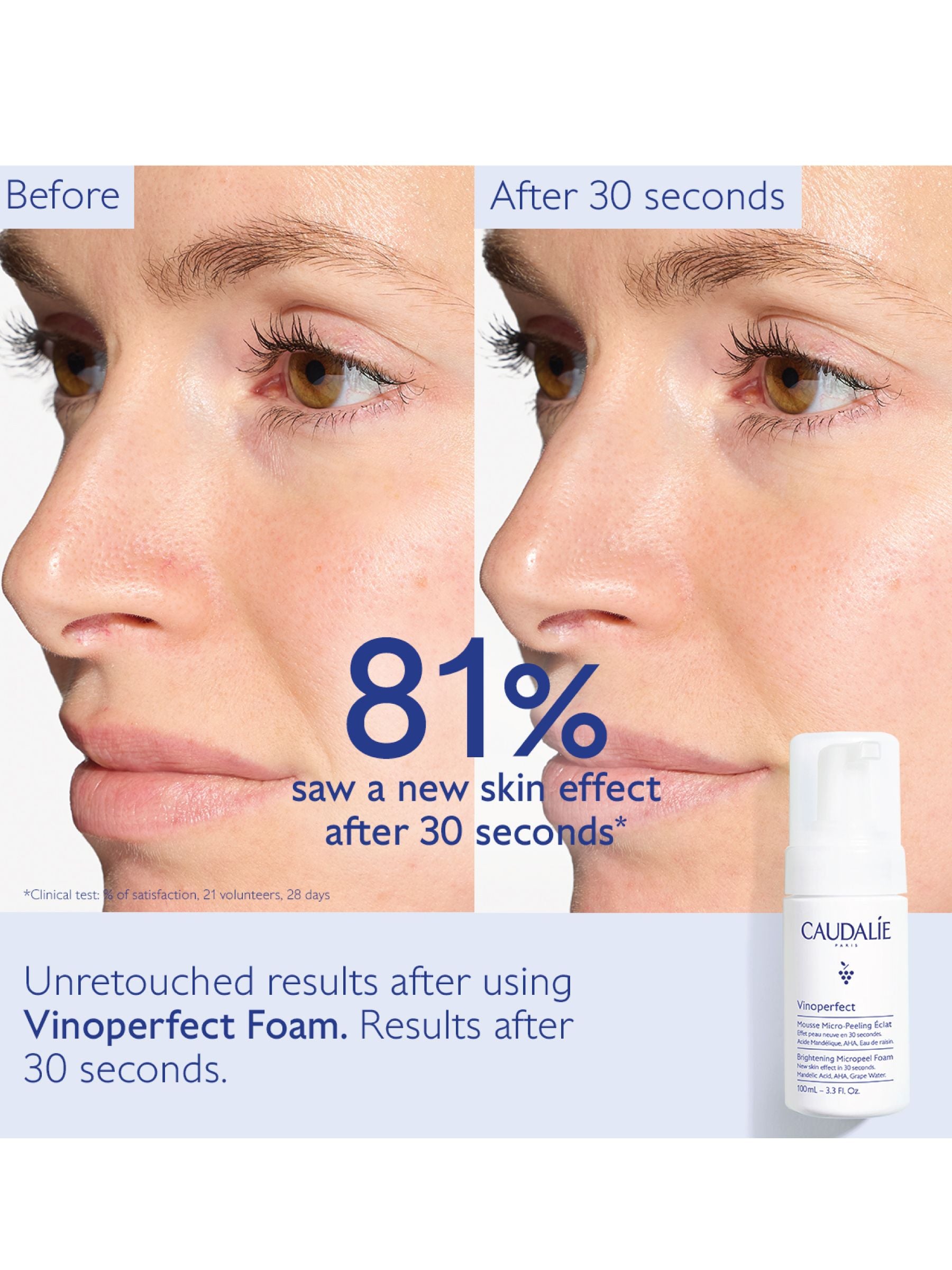 Caudalie Vinoperfect Brightening Micropeel Foam 100 mL - British product