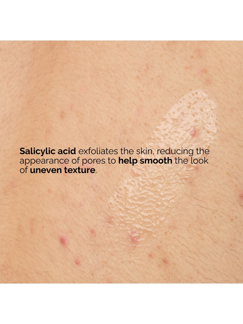 The Ordinary Salicylic Acid Body Serum 240ml (British brand)