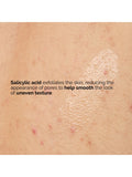The Ordinary Salicylic Acid Body Serum 240ml (British brand)