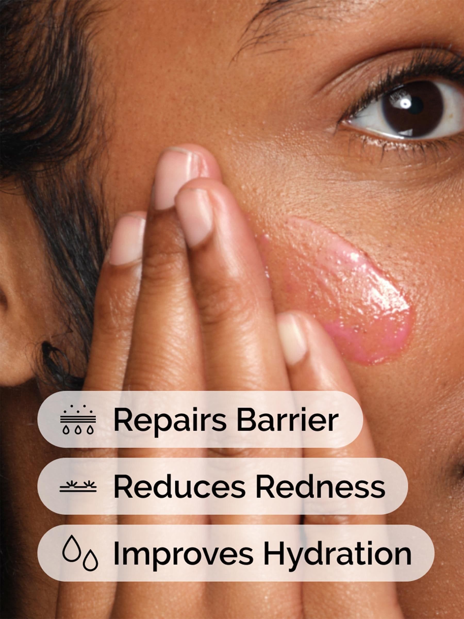 The Ordinary soothing and barrier support facial serum 30ml (British brand)