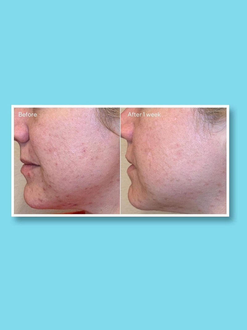 Murad Daily Clarifying Peel Mask 95ml, imported from the UK
