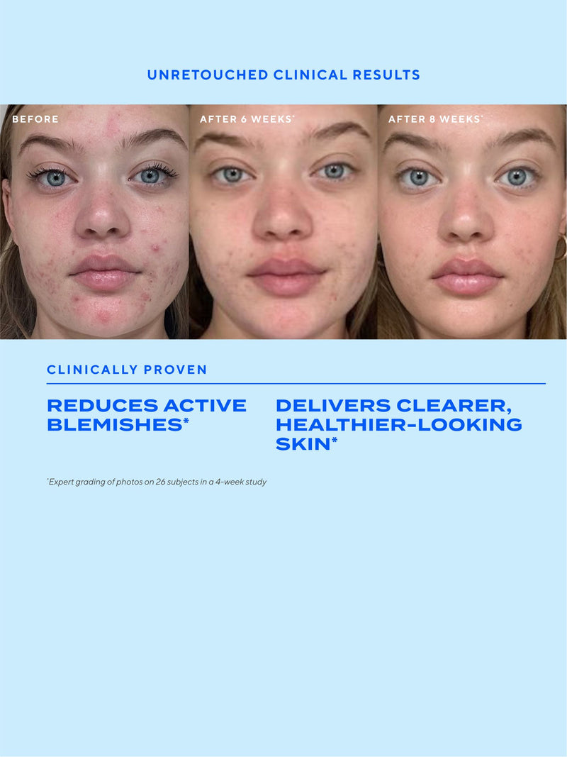Murad Biome Balancing Clear Prevent Blemish Treatment Serum