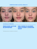 Murad Biome Balancing Clear Prevent Blemish Treatment Serum