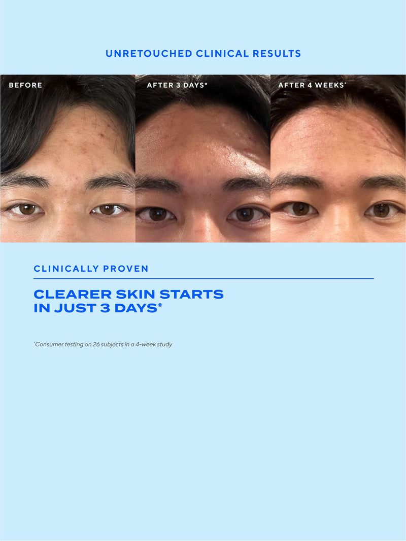 Murad Biome Balancing Clear Prevent Blemish Treatment Serum