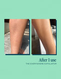 The Everywhere Exfoliator for KP 180ml