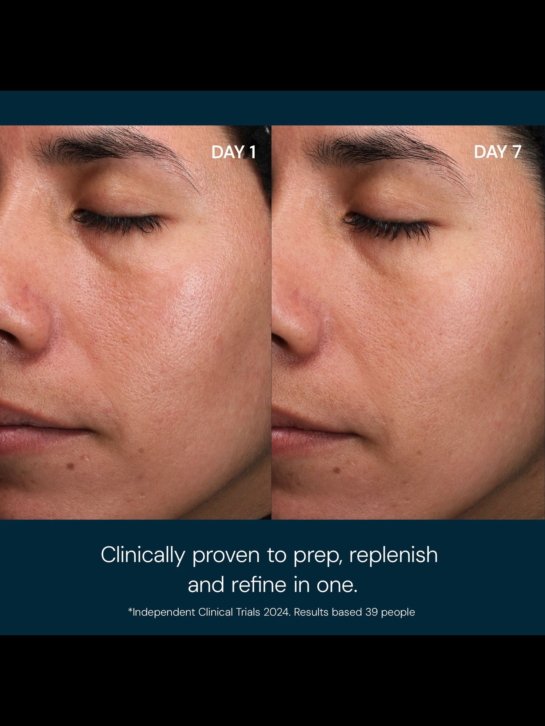 ELEMIS ProCollagen Toning Mist 150ml