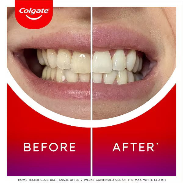 Colgate Max White LED Teeth Whitening Kit - British product
