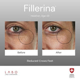 Fillerina 12HA Eye Cream Grade 4 15ml - British product