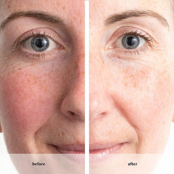 Avon Anew Renewal Power Serum - McGrocer