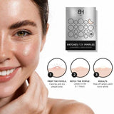 Benny Hancock SKIN 36 x Acne Pimple Patches - McGrocer