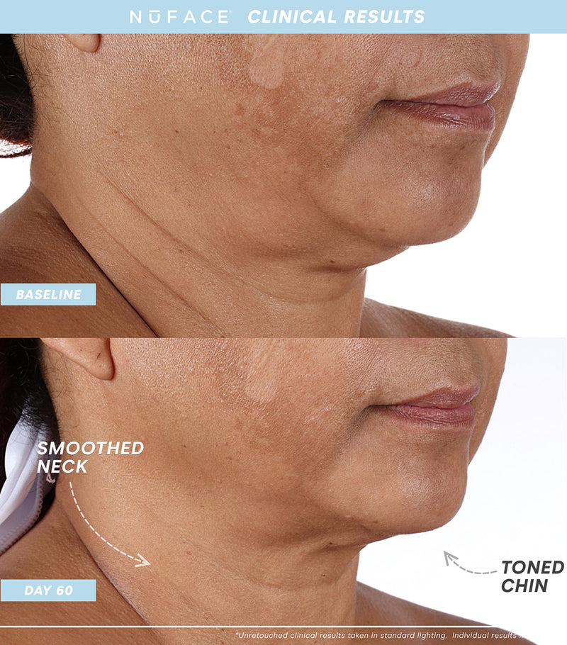 NuFACE Mini+ Facial Toning Device Starter Kit, imported from the UK