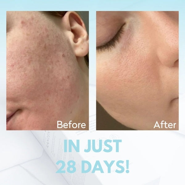 Kanzen Derma Facial Cleansing Water 125ml, UK version