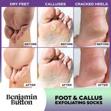 Benjamin Button luxury foot peel socks 5 pairs - British product