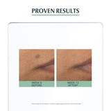 Eucerin DermoPurifyer Oil Control Triple Effect Serum 40ml