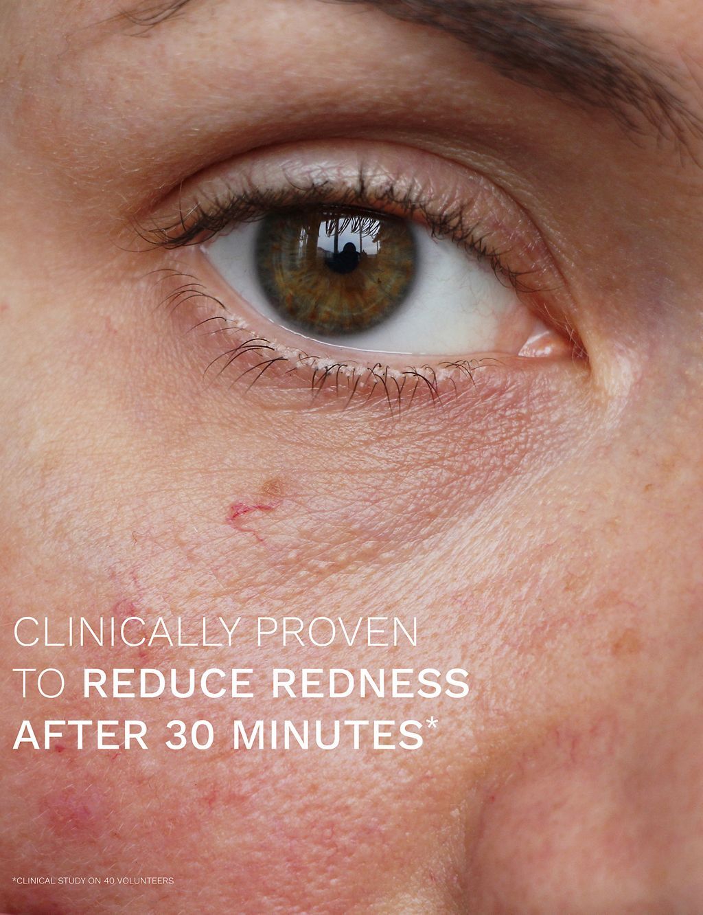 Evercalm&amp;trade; Redness Relief Serum 30ml