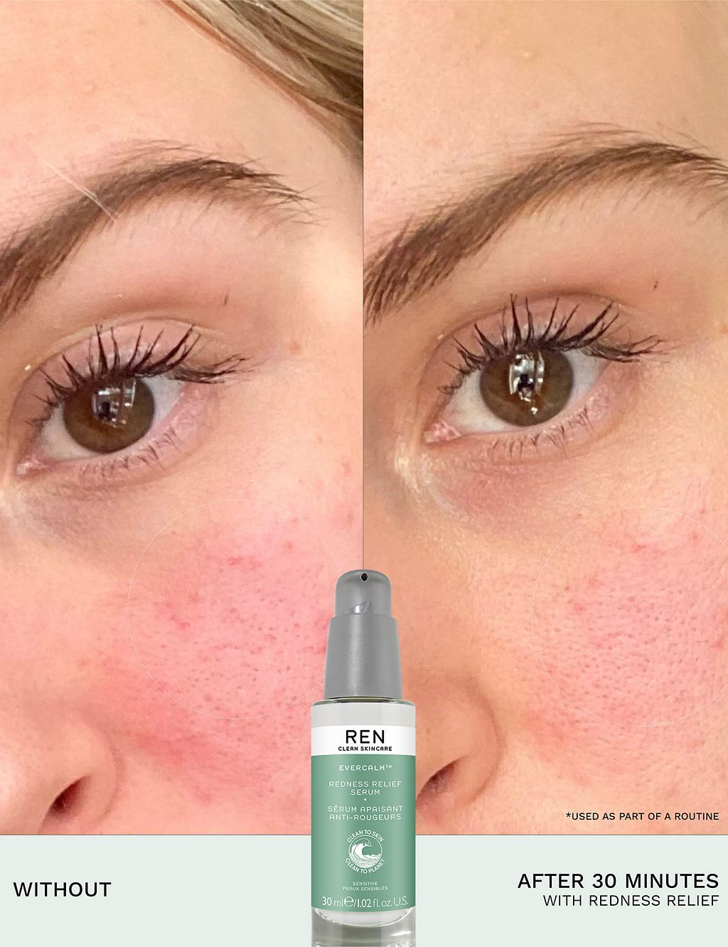 Evercalm&amp;trade; Redness Relief Serum 30ml