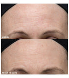 Dr Dennis Gross Alpha Beta Gentle Peel (5 Treatments)