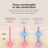 Shark Cryoglow Under-Eye Cooling LED Anti-Ageing & Blemish Repair Mask