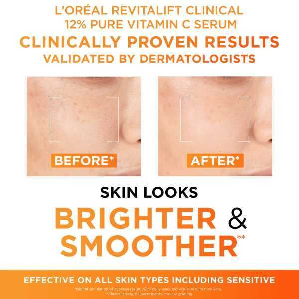 L'Oreal Paris 12% Vitamin C Serum &amp;amp; SPF 50 UV Fluid Duo 50ml