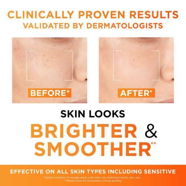 LOr&amp;eacute;al Revitalift Clinical 12% Pure Vitamin C Serum 30Ml