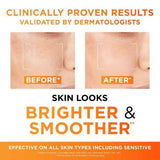 LOr&amp;eacute;al Revitalift Clinical 12% Pure Vitamin C Serum 30Ml