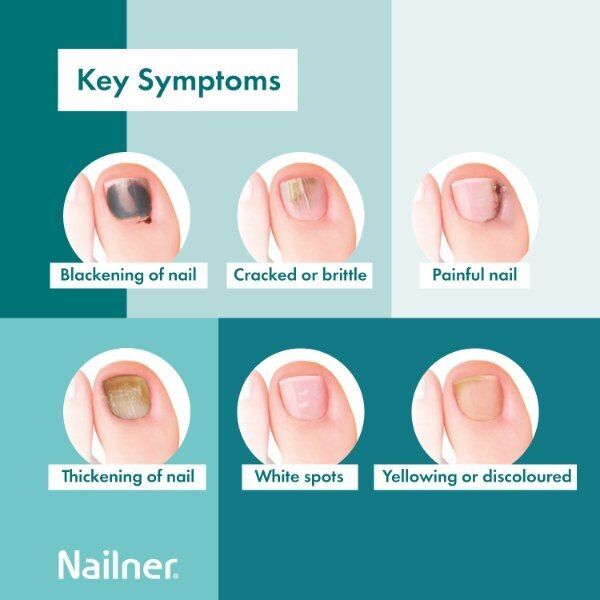 Nailner 2 in 1 Fungal Pen