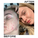 PERL Cosmetics British Pink Clay Mask &amp;amp; Illuminating Oil Set