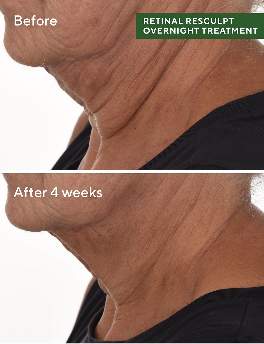 Retinal ReSculpt&amp;trade; Overnight Treatment 30ml