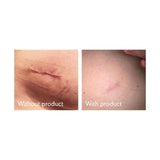Science of Skin Solution for Scars   30ml