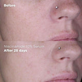 Skin Republic Niacinamide 10% + Zinc 1% Serum   30g